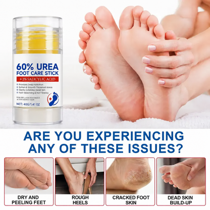 40g Urea Foot Care Stick, Moisturizing Hydrating Foot Care Cream