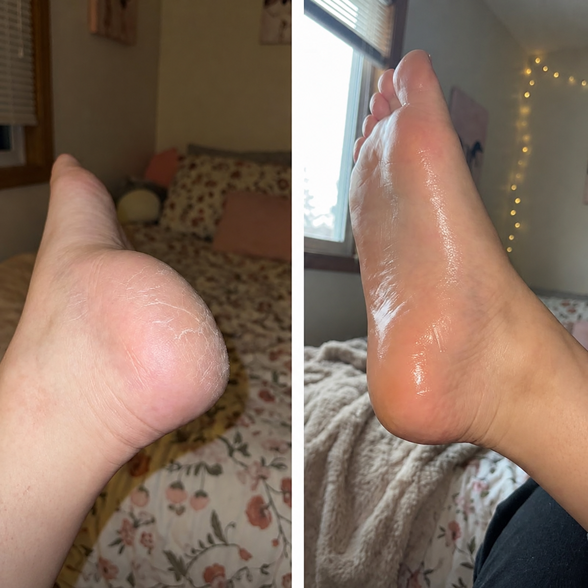 Foot before and after comparison 1