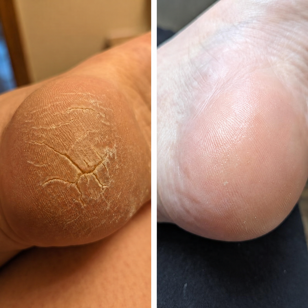 Foot-care customer comparison 2